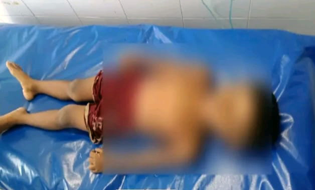 ভোলার আলীনগরে পুকুরে ডুবে শিশুর মৃ*ত্যু