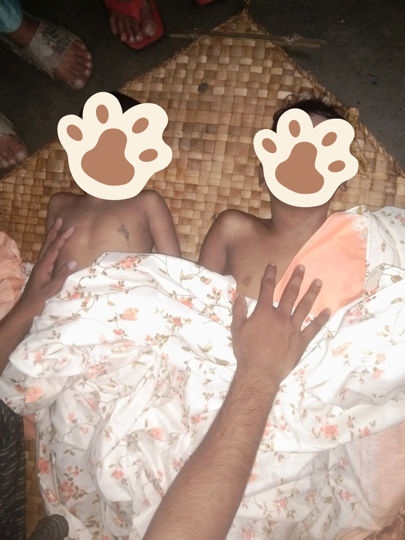 দৌলতখানে পানিতে ডুবে ২ বোনের মৃত্যু : শোকে স্তব্ধ গ্রামবাসী