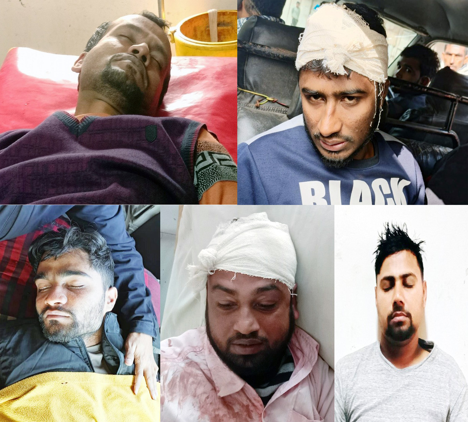 তজুমদ্দিনে বিএনপির দু’গ্রুপের সংঘর্ষ ॥ আহত-১৫