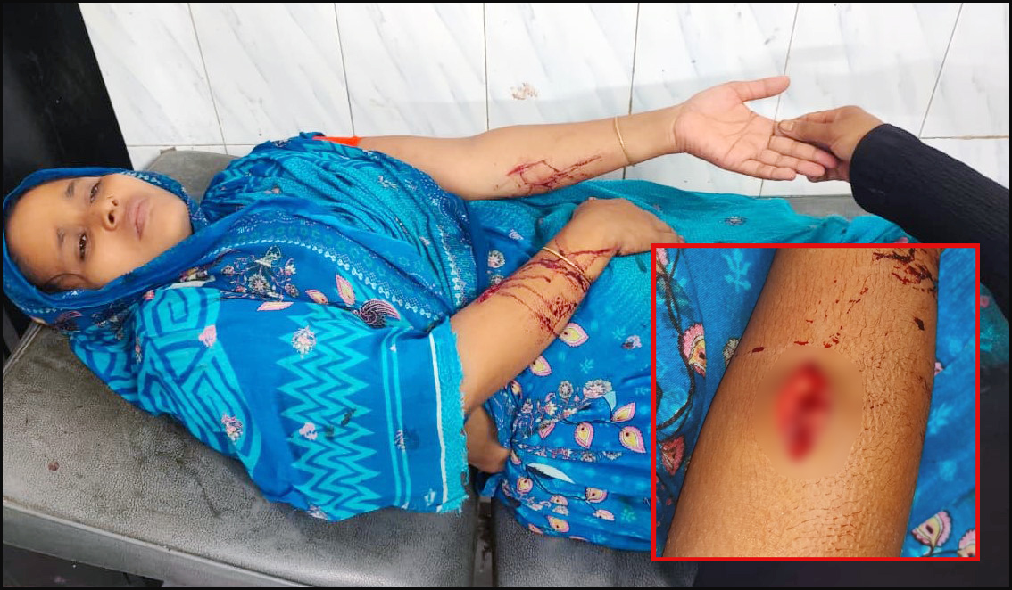 লালমোহনে রাতের আধারে গৃহবধুকে কুপিয়ে জখম