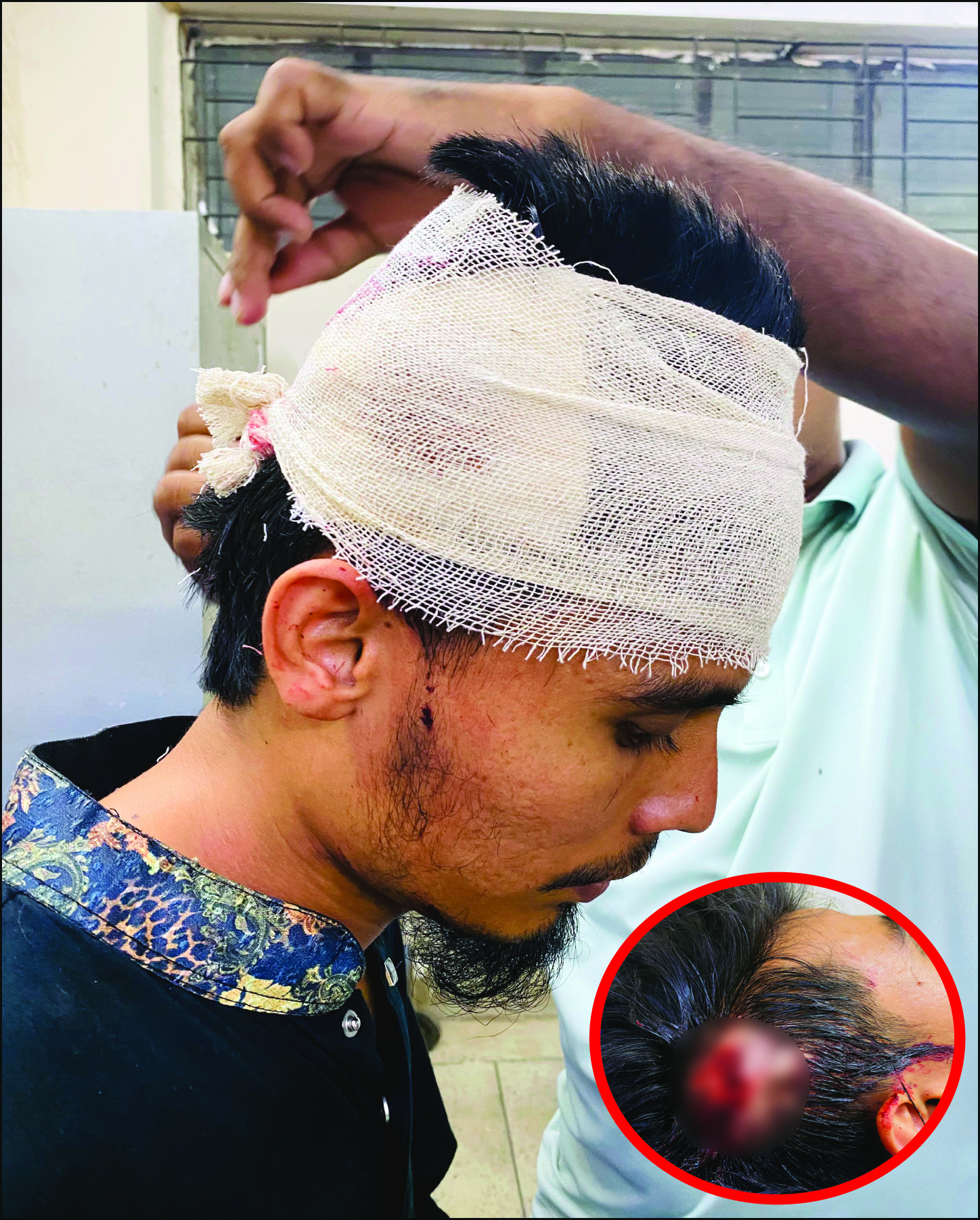 বোরহানউদ্দিনে কলেজ ছাত্রের ওপর হামলা, সুষ্ঠু তদন্ত ও বিচার দাবি